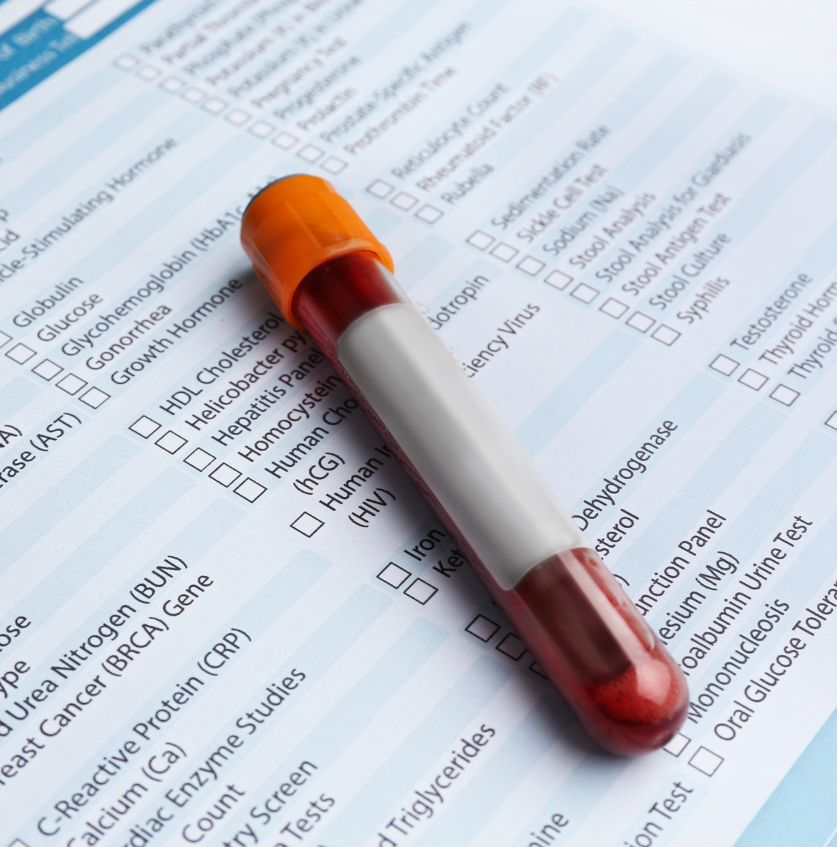 Cholesterol test appointment