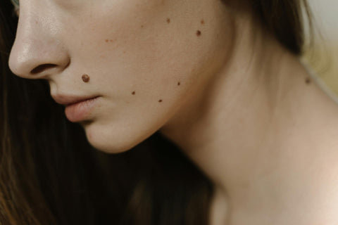 Mole Screening